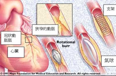 血管外科_血管脂肪瘤_血管外科收入
