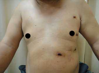 達文西手術系統