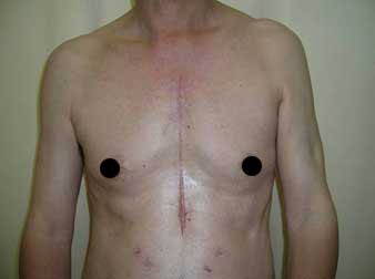 達文西手術系統